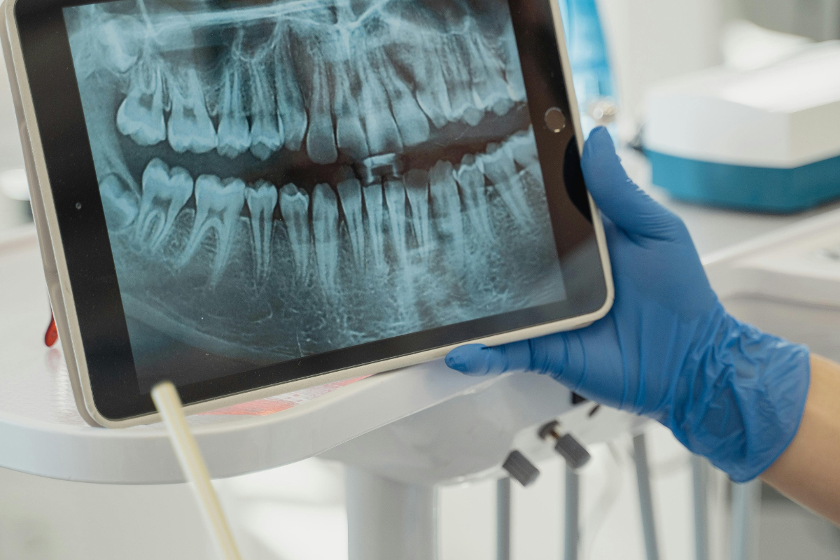The Future of Dentistry Comes from Slovakia: Slovak Investment Holding and KInIT Invest in AI:Dental